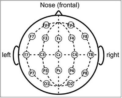 Patients with Alzheimer’s disease dementia show partially preserved parietal ‘hubs’ modeled from resting-state alpha electroencephalographic rhythms